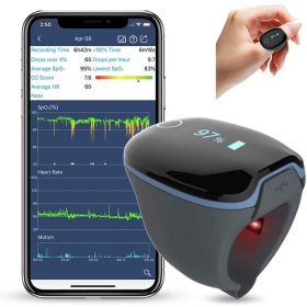   Viatom O2 Ring S1 '26 – Légzésfigyelő gyűrű - Alvási apnoe